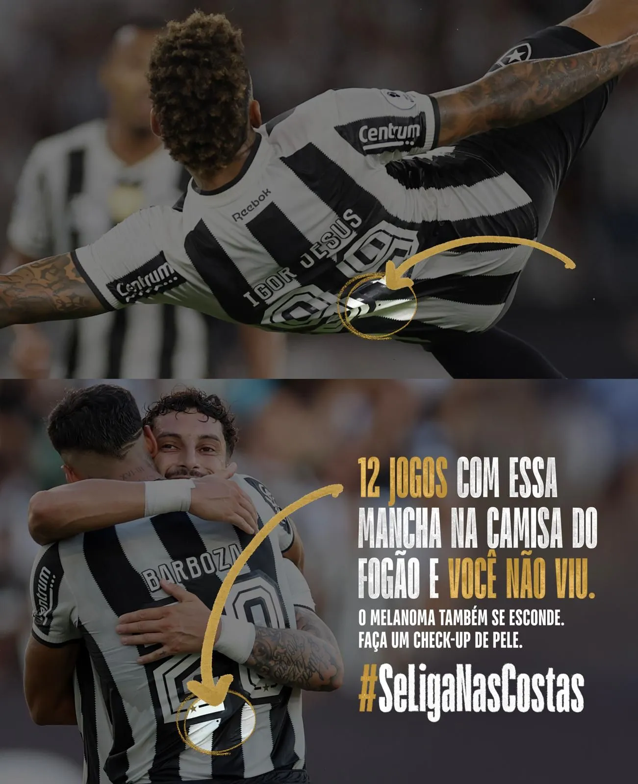 Instituto Melanoma Brasil impacta com campanha conscientização sobre o câncer de pele em parceria com o Botafogo