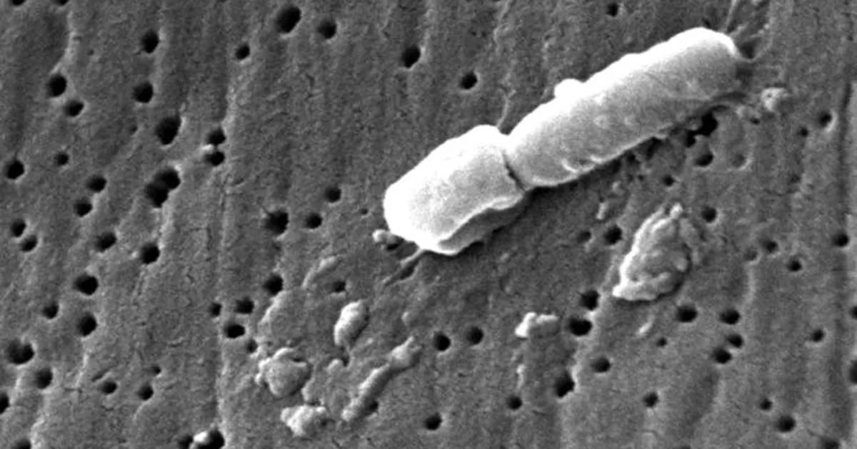 Superbactérias são encontradas em áreas agrícolas e animais silvestres de SP