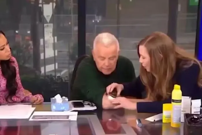 Apresentador descobre câncer de pele ao vivo durante programa de TV