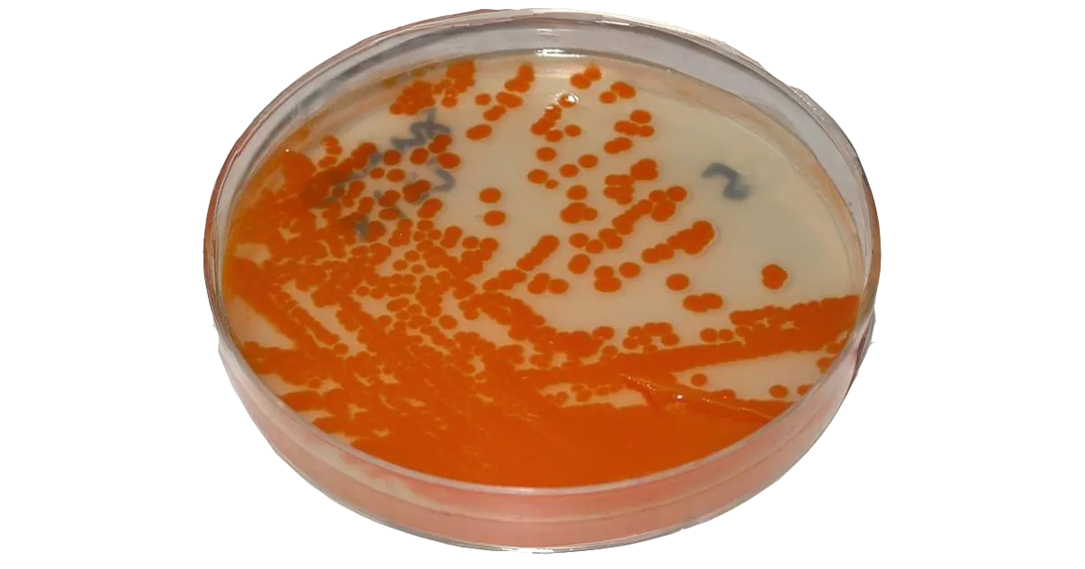 Bactéria comum em gestantes está circulando mais e com maior resistência aos antibióticos