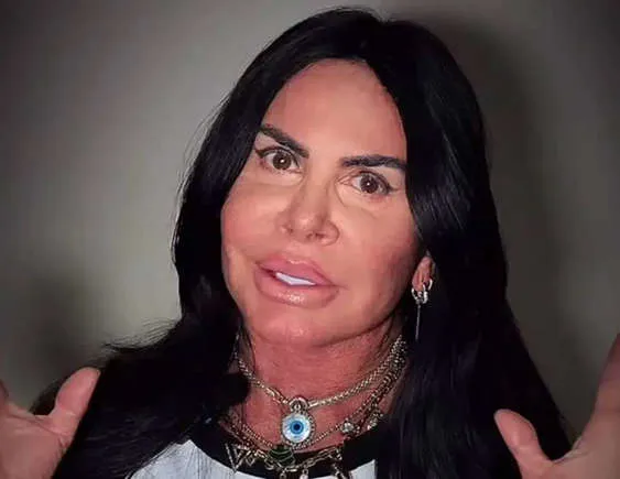 Gretchen se manifesta sobre críticas após novo procedimento estético