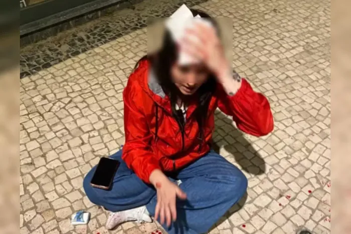 Brasileira leva pedrada na cabeça em Portugal: “Fala baixo, vaca”