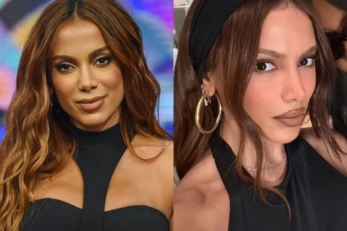 Anitta revela já ter feito mais de 50 procedimentos estéticos ao longo da vida