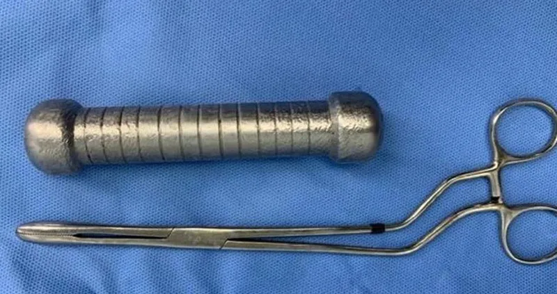 Brasileiro que ficou com peso de academia de dois quilos preso no reto é tema de estudo científico